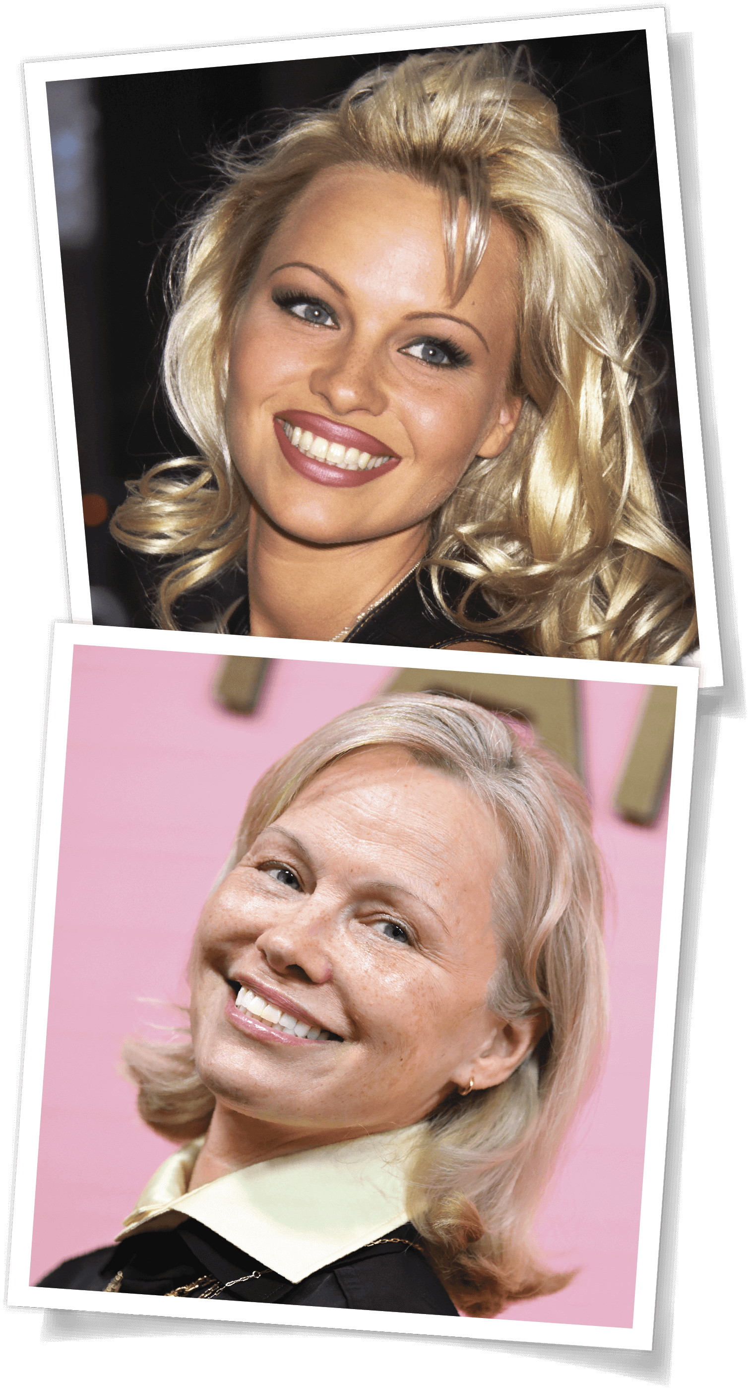 Photograph of Pamela Anderson from the 1990’s and a current picture of her.