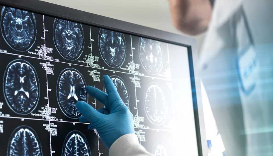 Close up of a doctor wearing a blue surgical glove examining a brain scan on a computer screen