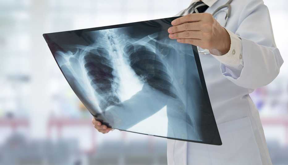 Lungs and heart x ray