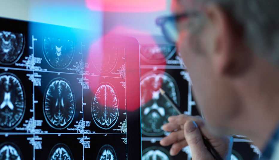 doctor looking at brain scans