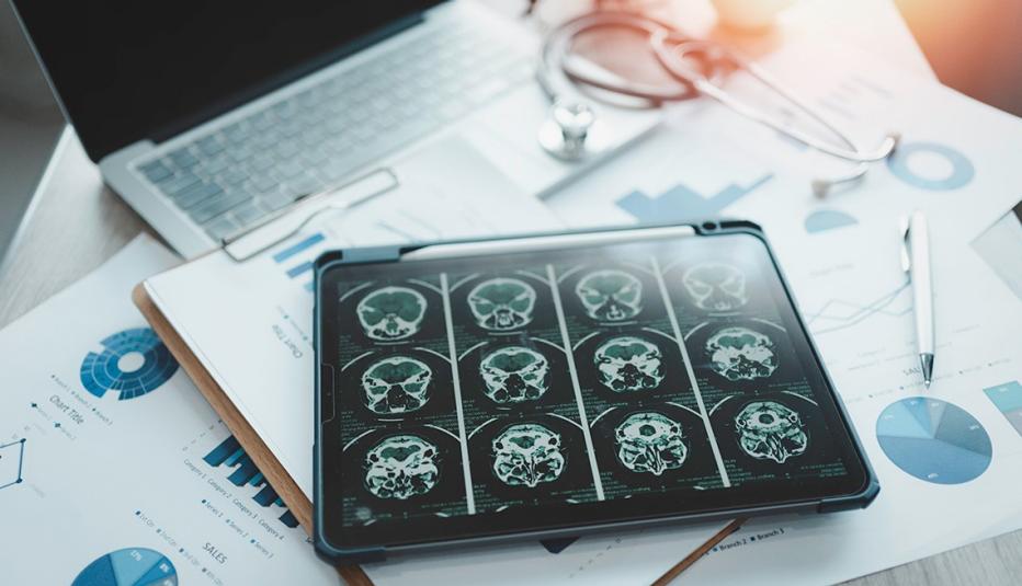 A digital tablet with brain scans on the screen