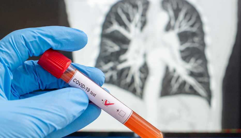 Coronavirus diagnosed x-ray cat tomography, CT scan, negative blood test for Coronavirus 