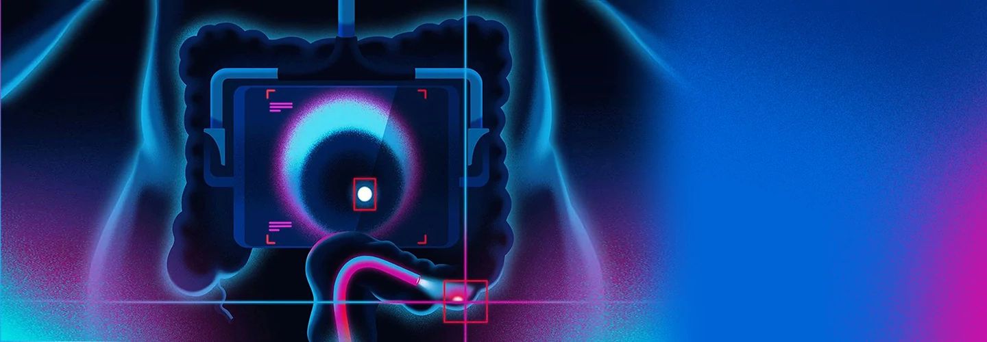 Ilustración digital de una radiografía intestinal