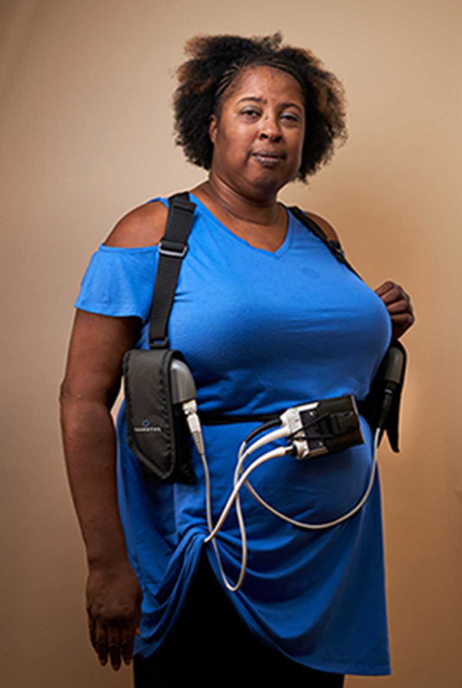 Brenda Smith y su bomba cardíaca