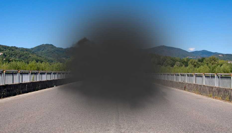 Vista de un paisaje a través de unos ojos con degeneración macular
