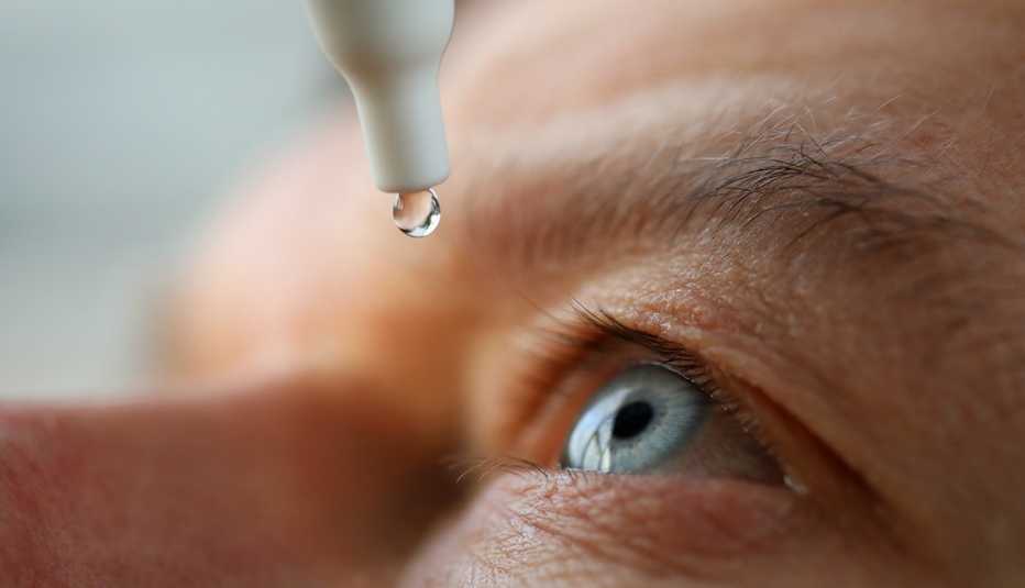 Acercamiento a la cara de una persona que recibirá una gota para la visión en un ojo.    