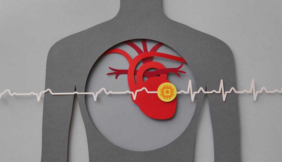 Ilustración de un torso de una persona donde se aprecia su corazón y sus latidos