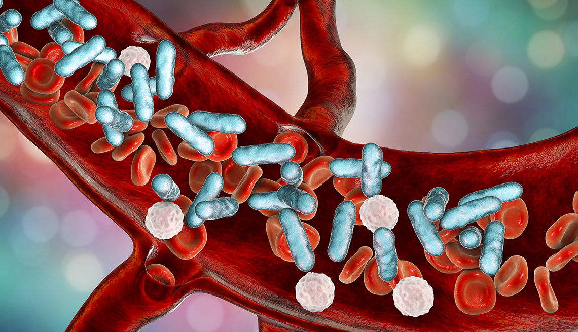 Ilustración del torrente sanguíneo que muestra las células rojas y bacteria