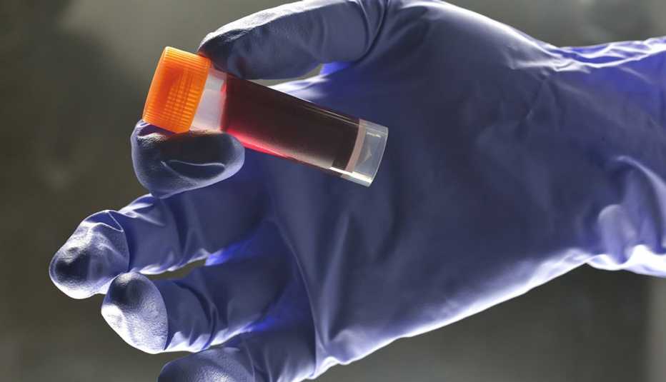 Mano con guante sosteniendo una muestra de sangre