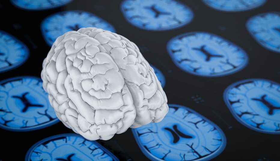 Cerebro sobre fondo de rayos x