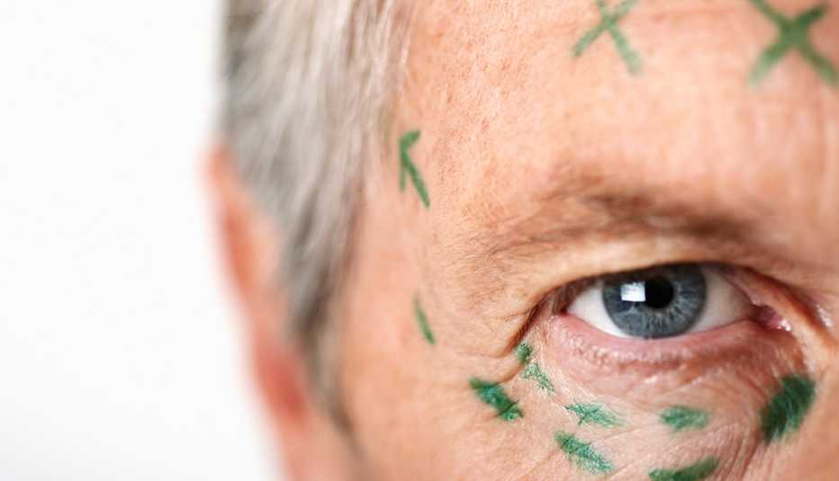 Perfil de un hombre listo para una cirugía plástica